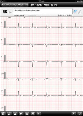 Wifi portable digital home iPad ECG machine , Heart rate monitor