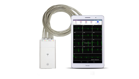 مسجل إشارة ECG أبيض نظام Andriod جهاز بلوتوث ECG